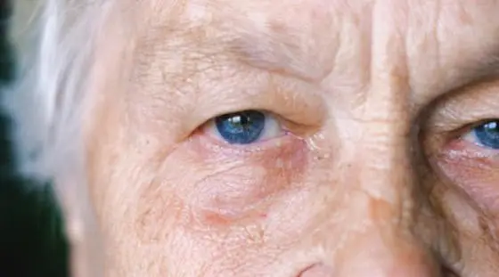 Les maladies neurod&eacute;g&eacute;n&eacute;ratives